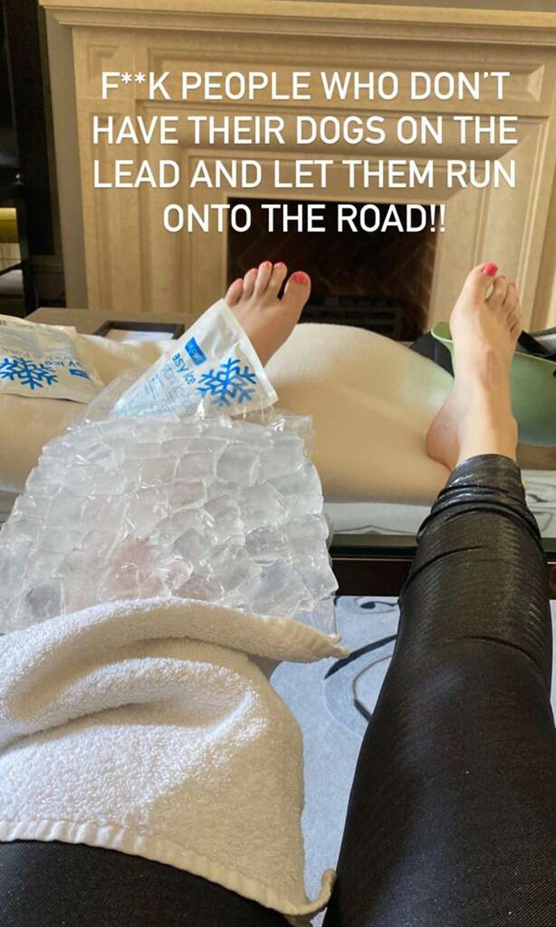 Rebel Wilson shows off her recent injury